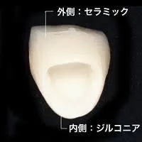 ジルコニアセラミクス